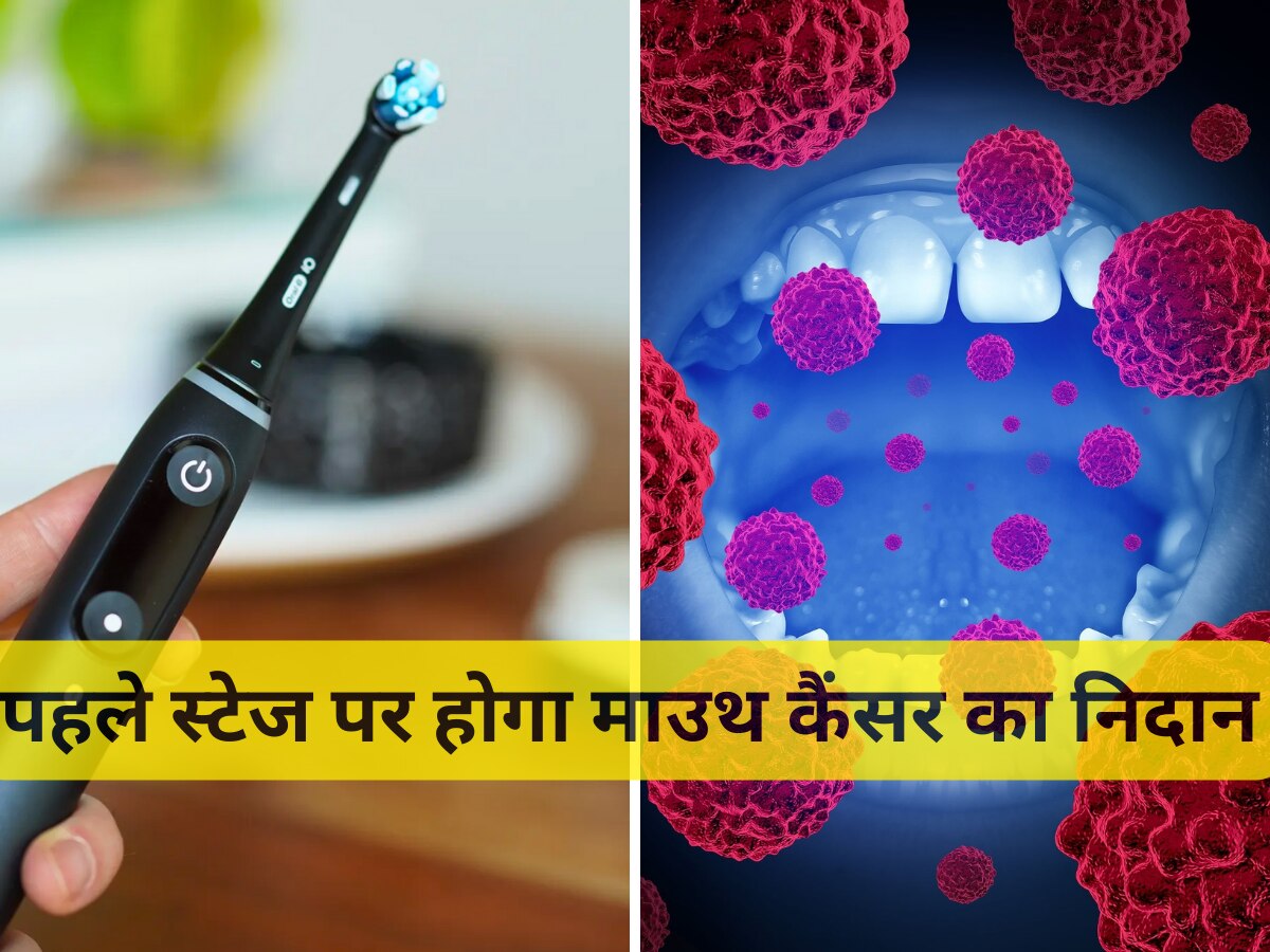 Cancer Diagnosis: Mouth Cancer के निदान के लिए बनाया गया टूथब्रश, पहले स्टेज पर ही पकड़ में आ जाएंगे कैंसर सेल्स