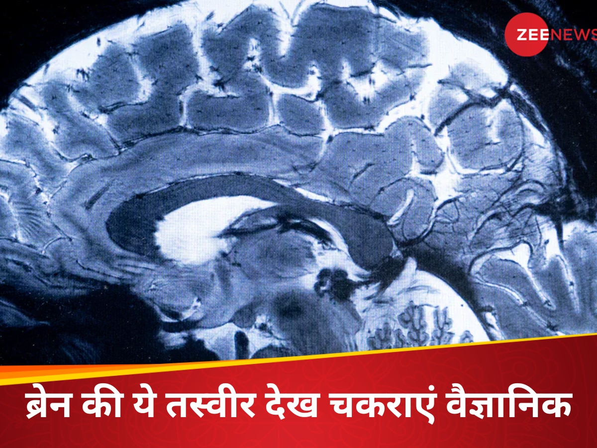 Brain Scan: दुनिया के सबसे पावरफुल MRI मशीन से किया गया दिमाग को स्कैन, तस्वीर में दिखे ब्रेन के रहस्यमयी हिस्से