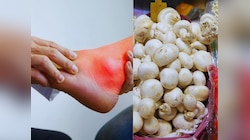 Uric Acid: क्या मशरूम खाने से बढ़ता है यूरिक एसिड? जानें किन चीजों का कर सकते सेवन!!