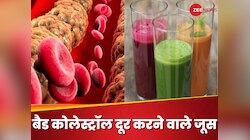 बैड कोलेस्ट्रॉल को कम करने के लिए पी सकते हैं ये 5 जूस, जानें एक्सपर्ट की सलाह