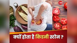 इन 7 आदतों से किडनी में पथरी का बढ़ता है रिस्क! भूलकर भी न करें ये गलतियां