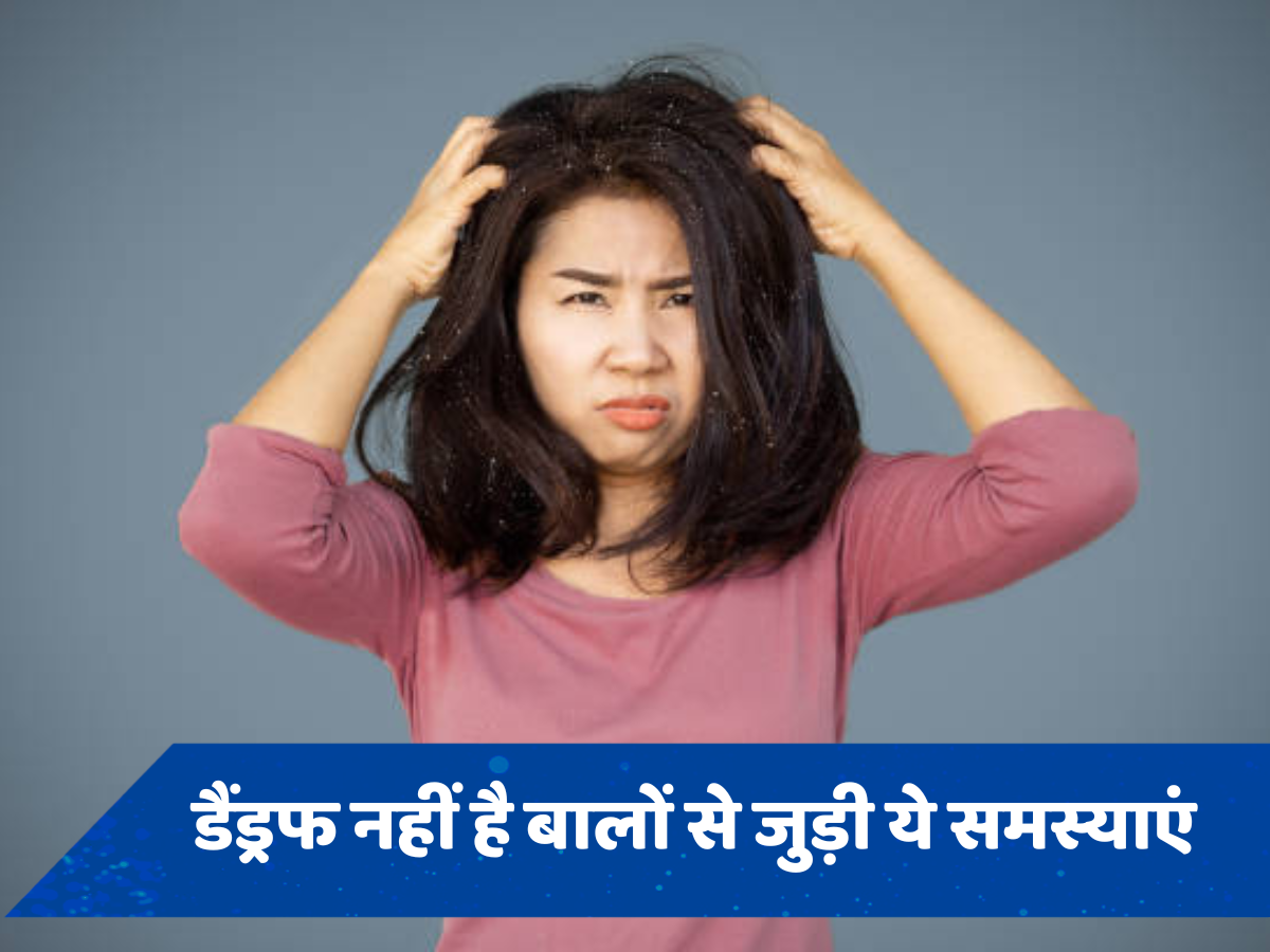 त्वचा से जुड़ी इन 3 परेशानियों को डैंड्रफ समझने की न करें गलती, धोना पड़ सकता है बालों से हाथ