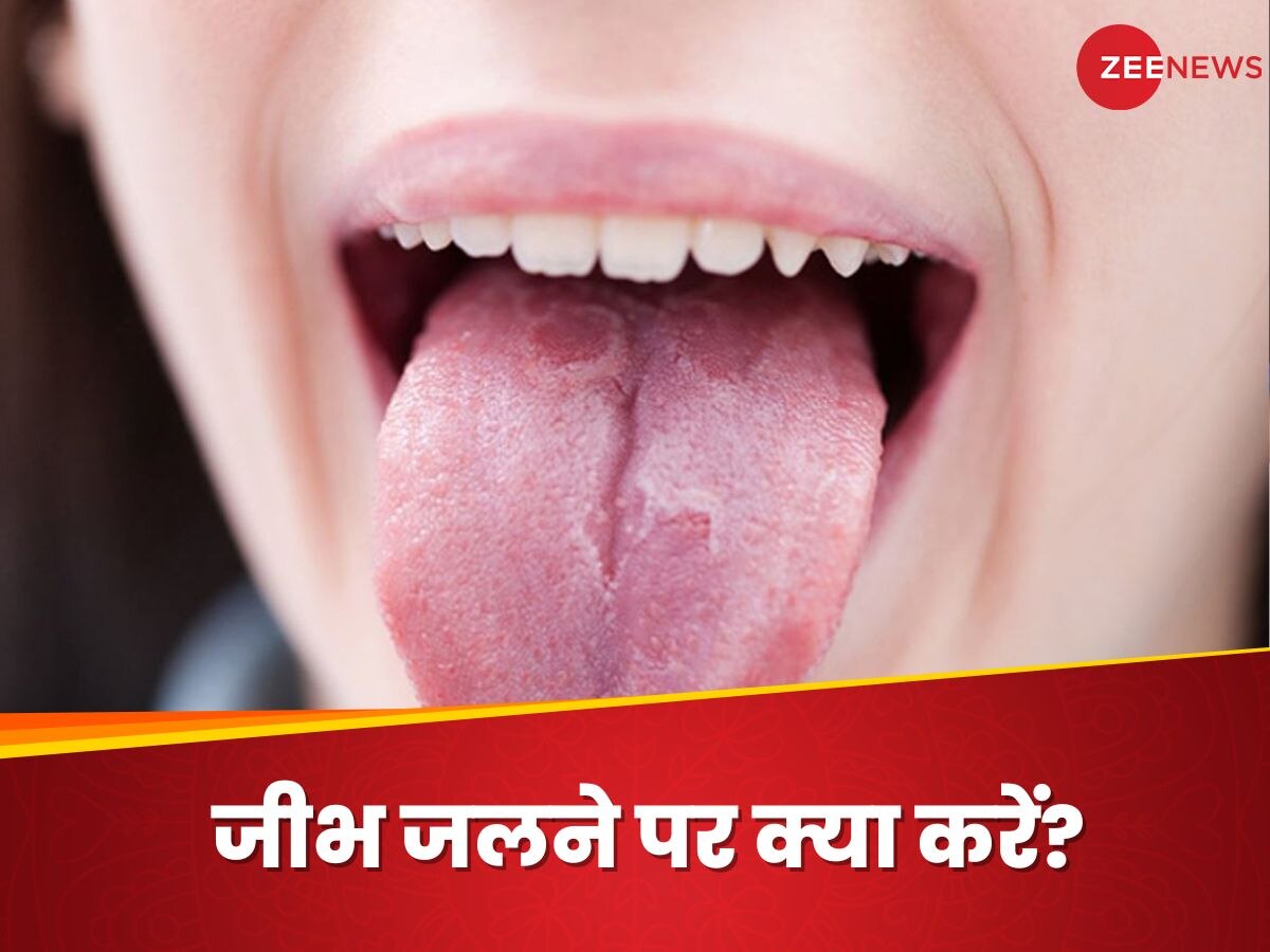 Burnt Tongue: गर्म चीजें खाने से जल गई जुबान? इन देसी उपाय से जल्द मिल सकती है राहत