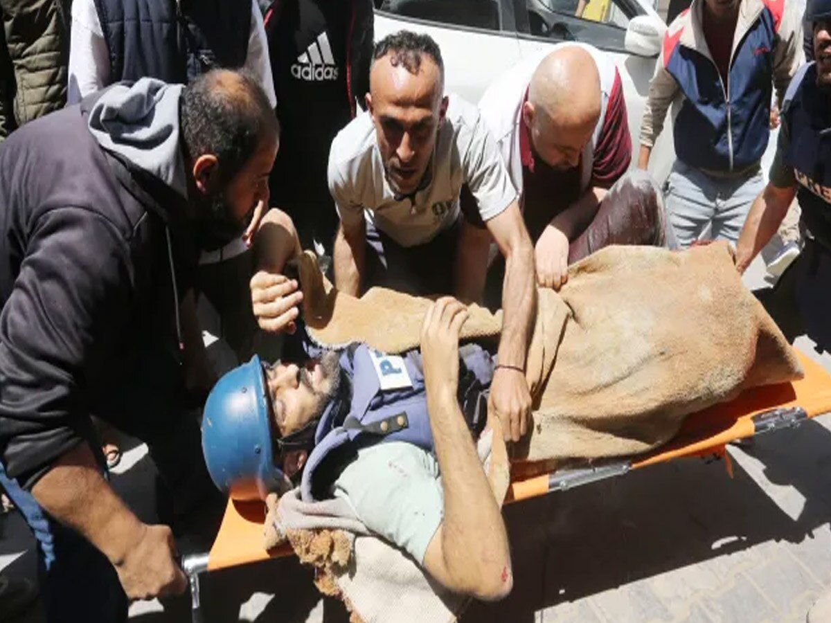Israel Attack in Gaza: इजराइली हमले में पत्रकार ने खोए अपने पैर, बोला जानबूझकर बनाया निशाना