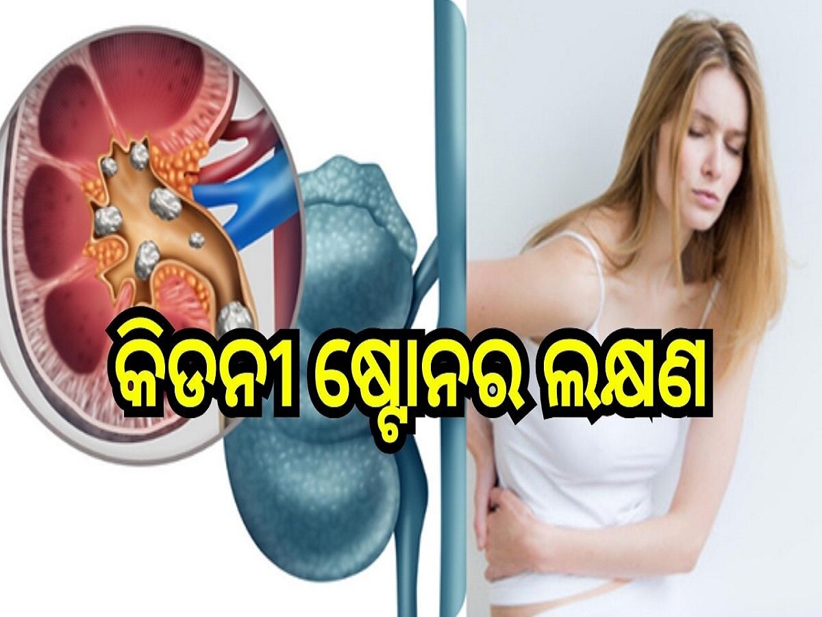 Kidney Stone: କେମିତି ଜାଣିବେ ଆପଣଙ୍କୁ ହୋଇଛି କିଡନୀ ଷ୍ଟୋନ? ଜାଣନ୍ତୁ ଏହାର ଲକ୍ଷଣ...