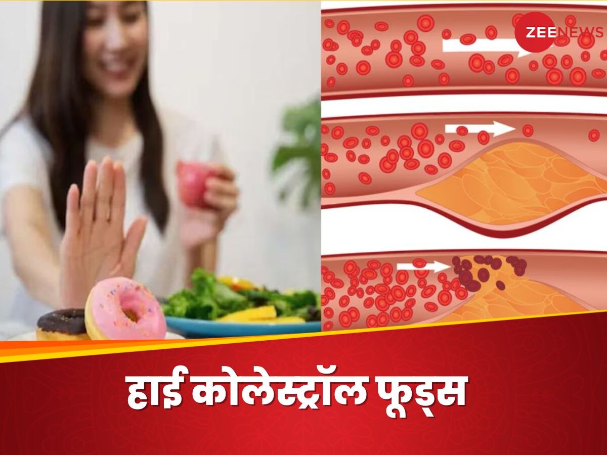 Cholesterol: इन 4 चीजों को डाइट से तुरंत करें आउट, महीनेभर में कम हो जाएगा कोलेस्ट्रॉल