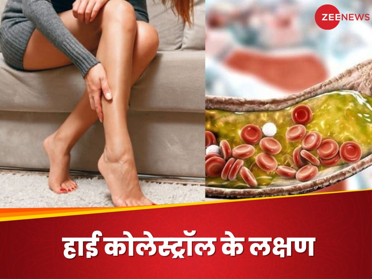 Cholesterol: शरीर के ये 3 हिस्‍से अगर दर्द से हो जाएं चूर, तो समझ जाएं कि बढ़ चुका है कोलेस्ट्रॉल