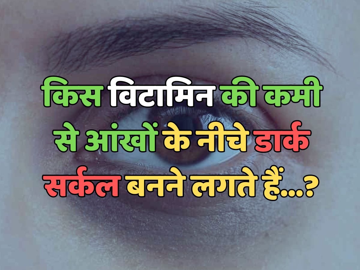 Due to deficiency of which vitamin dark circles start forming under the eyes