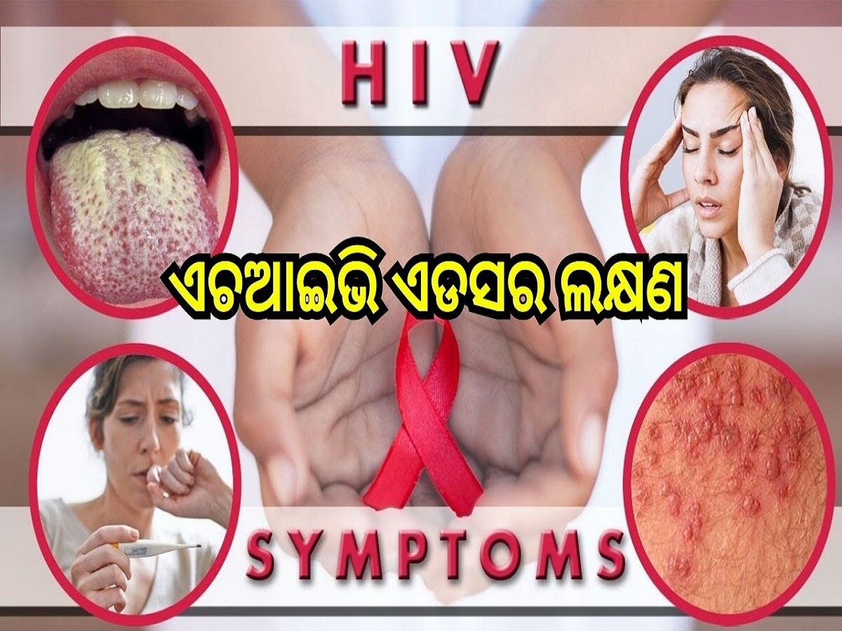 HIV Aids: ଏଚଆଇଭି ଏଡସ ହେଲେ ଶରୀରରେ ଦେଖା ଦେଇଥାଏ ଏହି ସବୁ ଲକ୍ଷଣ...