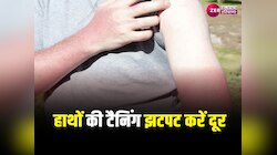Skin Care: हाथों की टैनिंग दूर करने के लिए फॉलो करें ये टिप्स