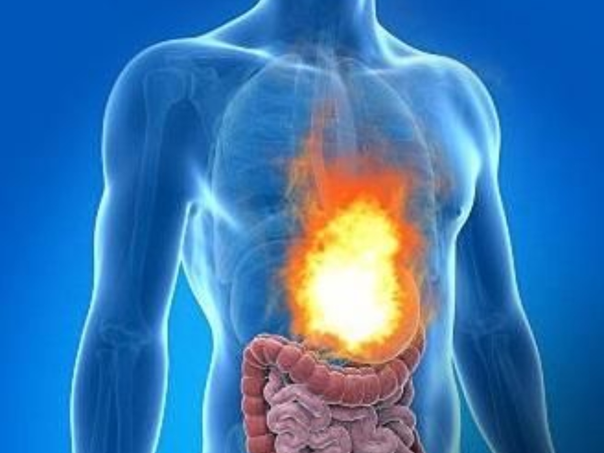 पेट के एसिड