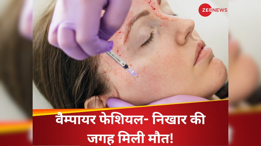 vampire facial causes hiv infection 3 women died after getting it from ...