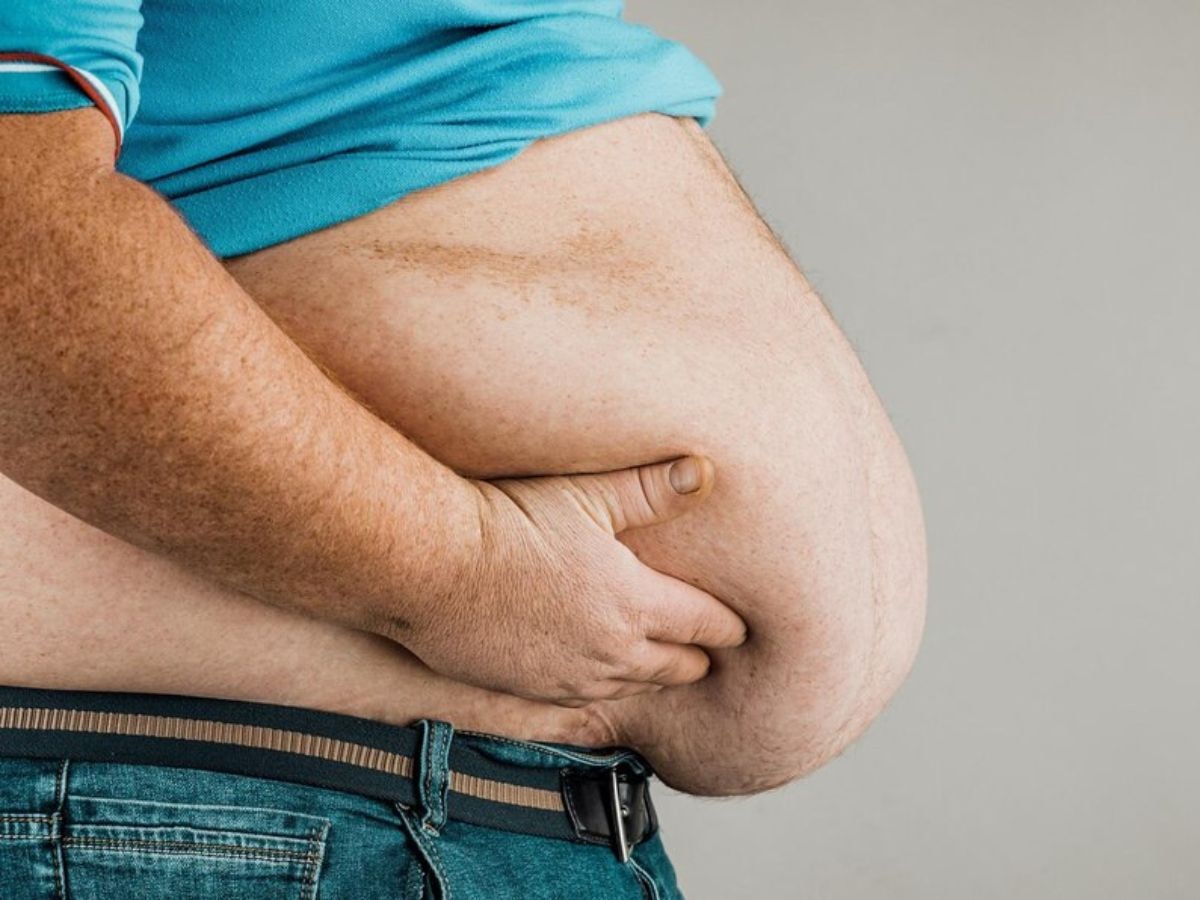 Obesity: मोटापा बढ़ा सकता है डिमेंशिया का खतरा? जानें क्या कहता है लेटेस्ट रिसर्च