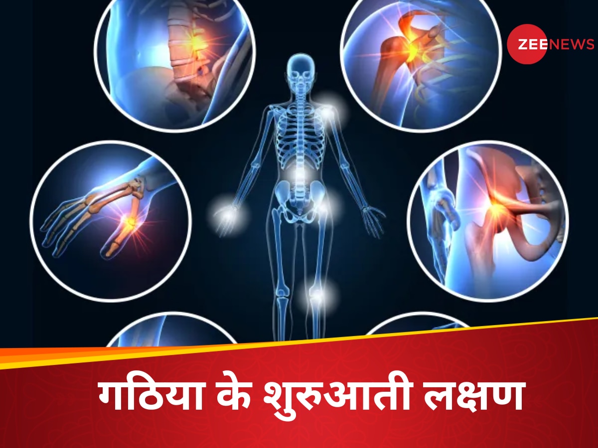 Arthritis Sign: गठिया होने के 3 साल पहले ही दिख जाते हैं इसके लक्षण, स्टडी में हुआ खुलासा