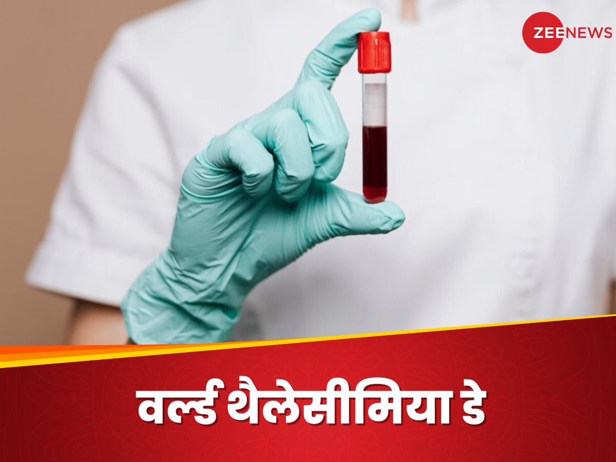 World Thalassemia Day:  थैलेसीमिया के लक्षणों को कैसे पहचानें? जानिए बीमारी के लिए पैरेंट्स कितने जिम्मेदार