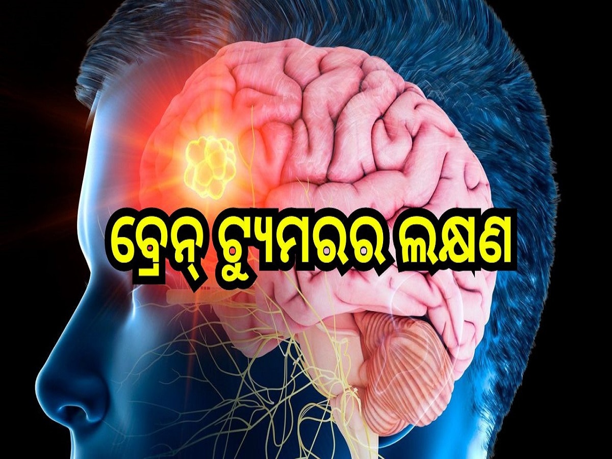 Brain Tumor: ବ୍ରେନ୍ ଟ୍ୟୁମର ହେବା ପୂର୍ବରୁ ଶରୀରରେ ଦେଖା ଦେଇଥାଏ ଏହି ସବୁ ଲକ୍ଷଣ..