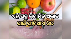 ଗରମ ସିଜିନରେ ମଧ୍ୟ ଆପଣଙ୍କ ଓଠ ଫାଟି ଯାଉଛି କି? ଶରୀରରେ ଥାଇପାରେ ଏହି ସବୁ ଭିଟାମିନର ଅଭାବ