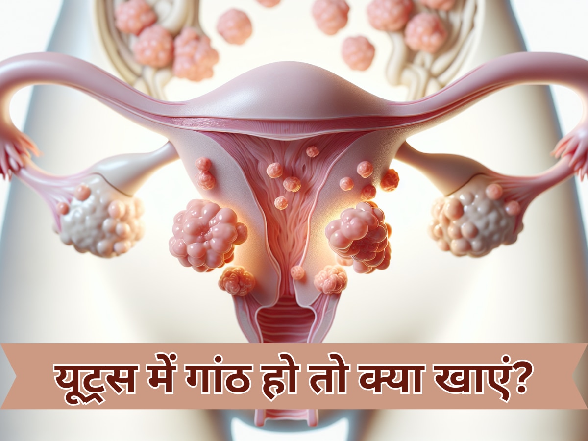 Fruits For Fibroids: बच्चेदानी में बन गई है गांठ, तो खाना शुरू कर दें ये 5 फल; सिकुड़ने लगेगा फाइब्रॉयड ट्यूमर