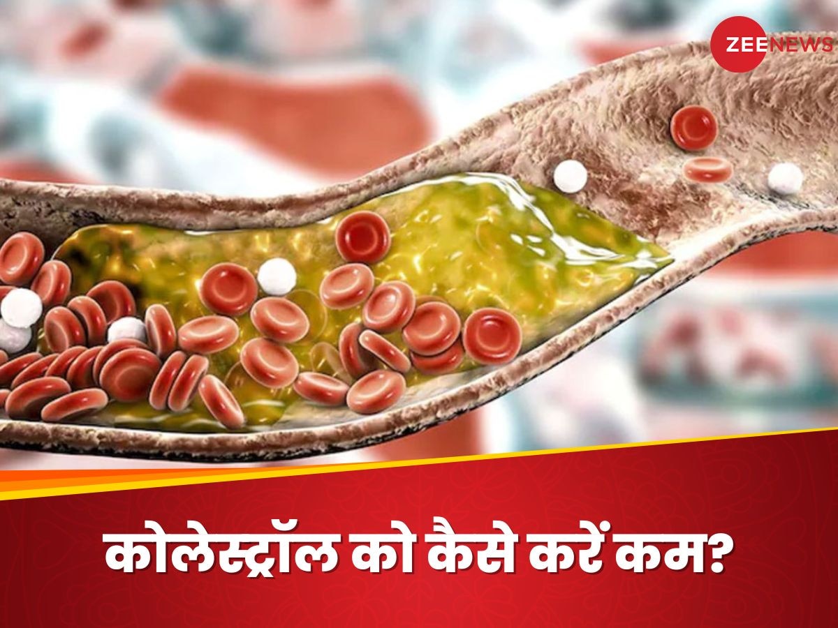 High Cholesterol: आपकी जान का दुश्मन है नसों में जमा बैड कोलेस्ट्रॉल, रोजाना 2 चीजें खाएंगे तो दूर होगा खतरा