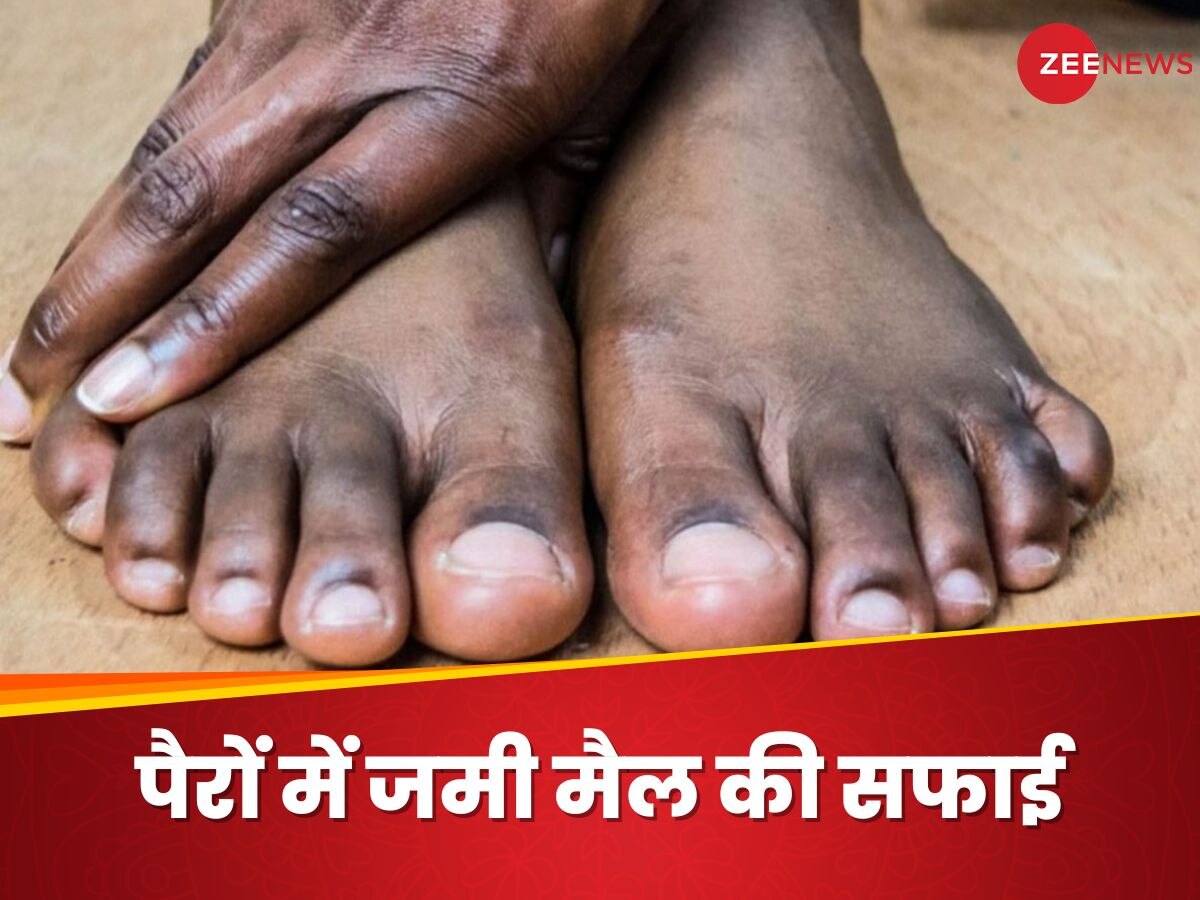 Feet Tanning: पैरो में जमी मैल की वजह से नहीं पहन पा रहे ओपन फुटवियर? 4 तरीके से दूर करें कालापन