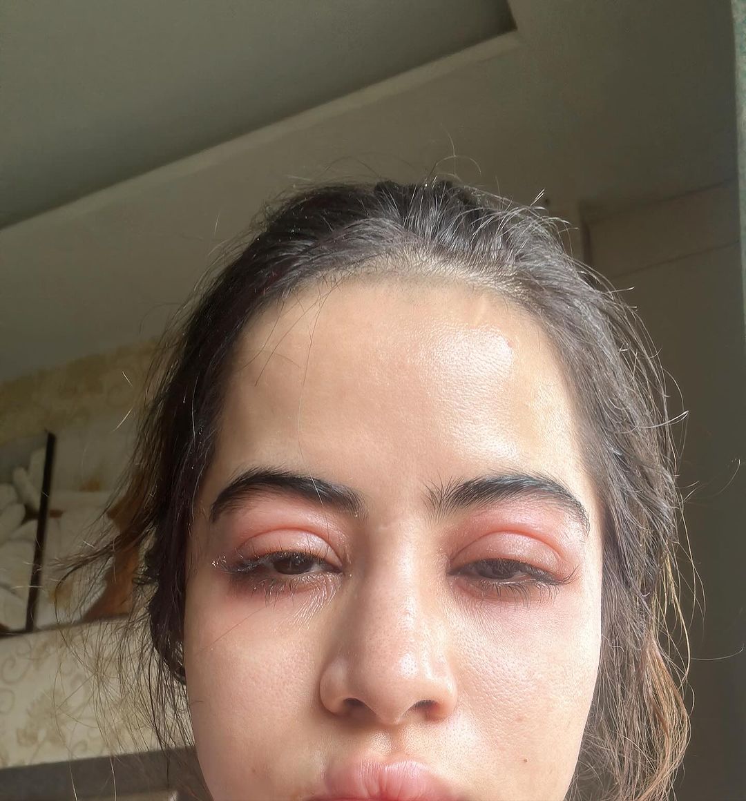 बिगड़ गया चेहरा