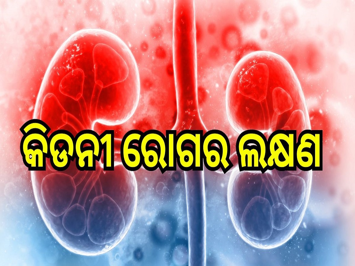 Kidney Health: କିଡନୀ ରୋଗ ହେବା ପୂର୍ବରୁ ଶରୀରରେ ଦେଖା ଦେଇଥାଏ ଏହି ସବୁ ଲକ୍ଷଣ