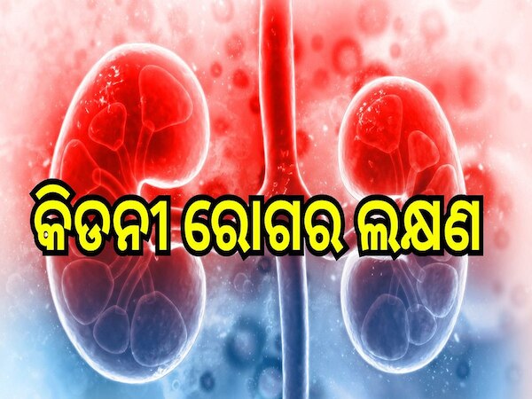 Kidney Health: କିଡନୀ ରୋଗ ହେବା ପୂର୍ବରୁ ଶରୀରରେ ଦେଖା ଦେଇଥାଏ ଏହି ସବୁ ଲକ୍ଷଣ