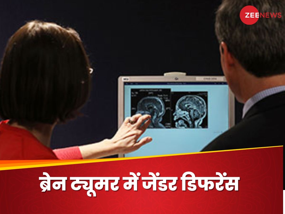 क्या ब्रेन ट्यूमर महिलाओं और पुरुषों को अलग तरह से परेशान करता है? न्यूरोसर्जन से जानिए जवाब