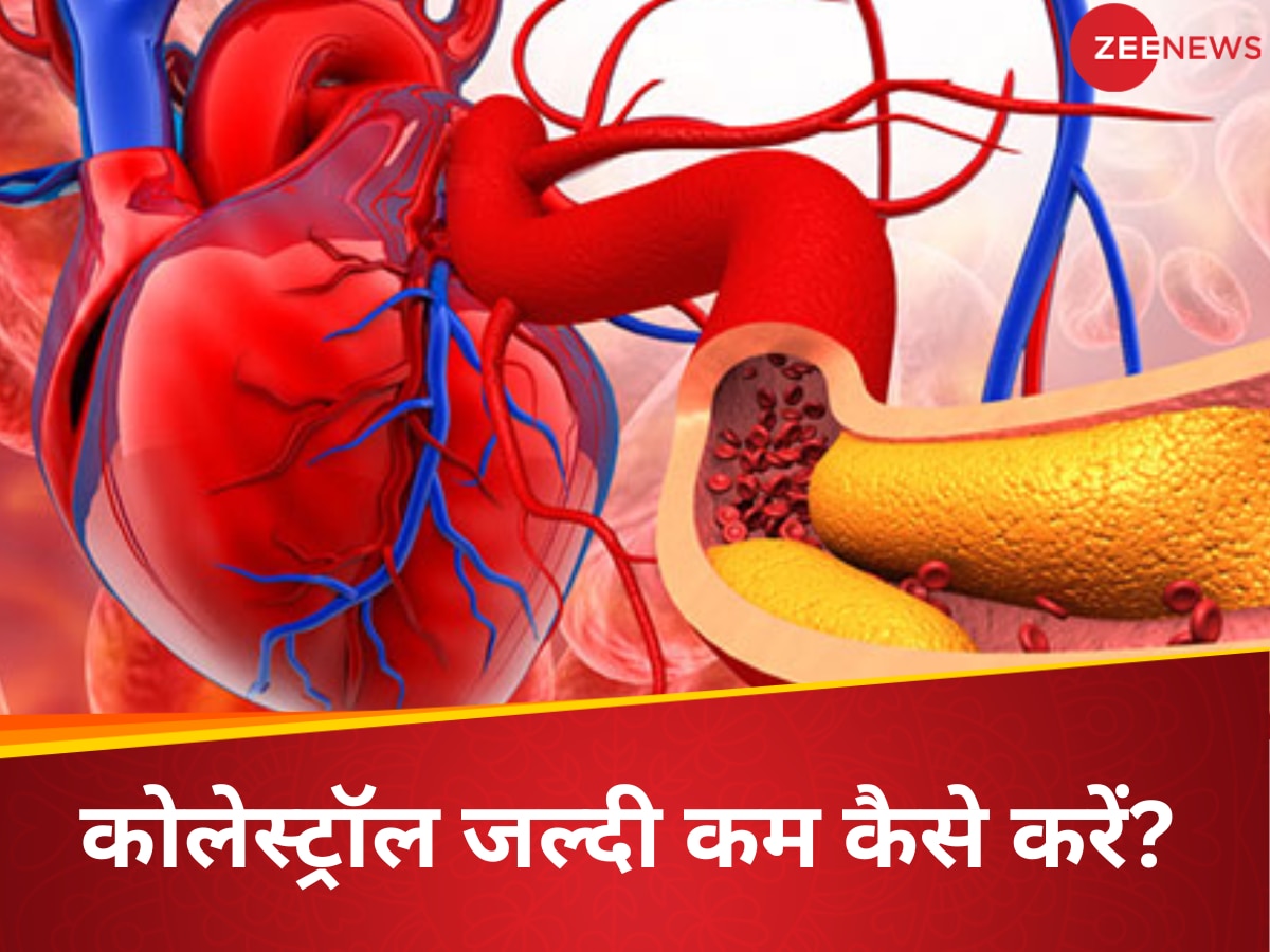 Drink For Cholesterol: दिल को जाम करने वाले बैड कोलेस्ट्रॉल का रामबाण इलाज है ये ड्रिंक, पीने से साफ हो जाएगा धमनी में भरा गंदा फैट