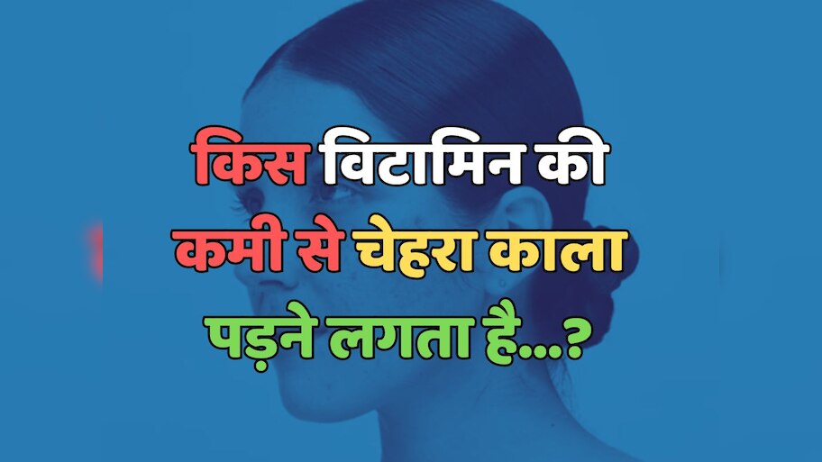 Trending Quiz : किस विटामिन की कमी से चेहरा काला पड़ने लगता है?