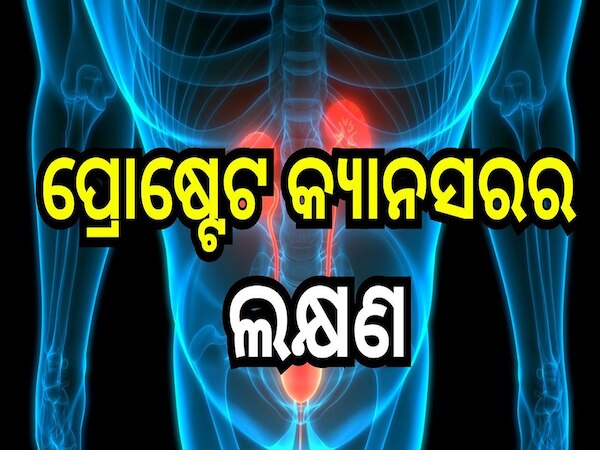 Prostate Cancer: ପ୍ରୋଷ୍ଟେଟ କ୍ୟାନସର୍ ପୂର୍ବରୁ ଶରୀରରେ ଦେଖା ଦେଇଥାଏ ଏହି ସବୁ ଲକ୍ଷଣ...