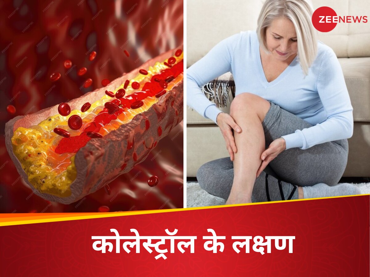 High Cholesterol Symptoms: टेस्ट की नहीं जरूरत, पैरों में चलते-फिरते नजर आए ये संकेत तो समझ जाएं बॉडी में भर रहा है गंदा कोलेस्ट्रॉल