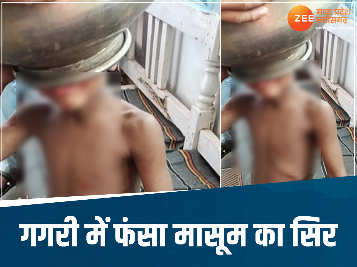 5 year old child head got stuck in the steel 5 year old child head got stuck in the steel