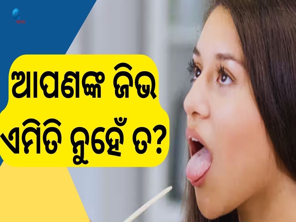Tongue color Sign: ଜିଭ ରଙ୍ଗରୁ ଜାଣିବେ ଆପଣଙ୍କୁ କି ରୋଗ? ବେଳହୁଁ ସାବଧାନ ! Tongue color Sign: ଜିଭ ରଙ୍ଗରୁ ଜାଣିବେ ଆପଣଙ୍କୁ କି ରୋଗ? ବେଳହୁଁ ସାବଧାନ !