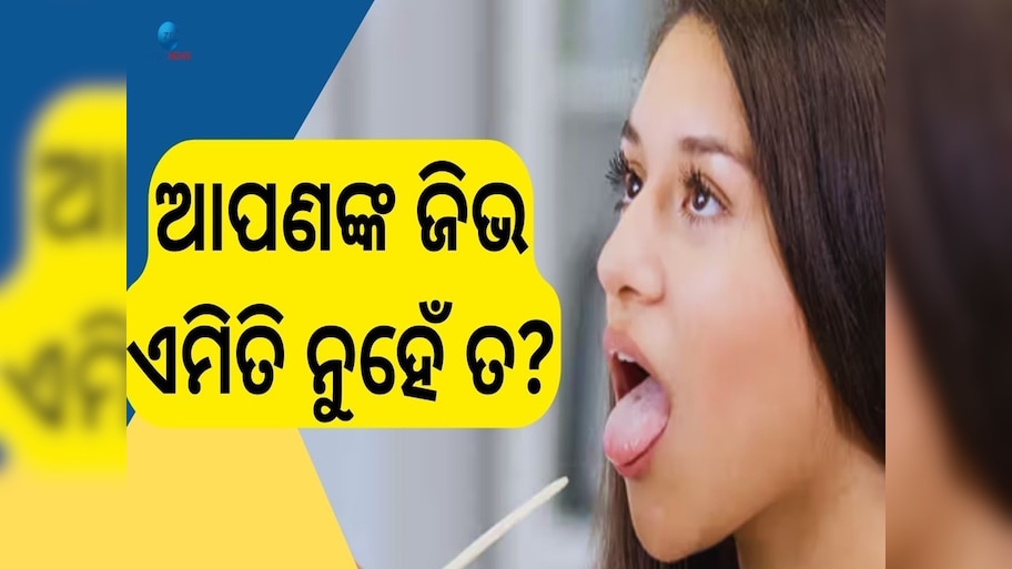 Tongue color Sign: ଜିଭ ରଙ୍ଗରୁ ଜାଣିବେ ଆପଣଙ୍କୁ କି ରୋଗ? ବେଳହୁଁ ସାବଧାନ !