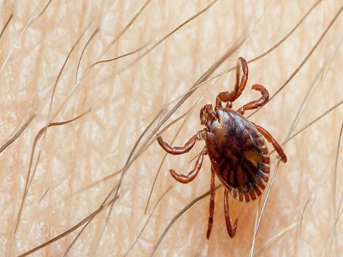 Pakistan में Congo Virus का 13वां केस आया सामने, कितनी खतरनाक है यह बीमारी, क्या हैं इसके लक्षण?