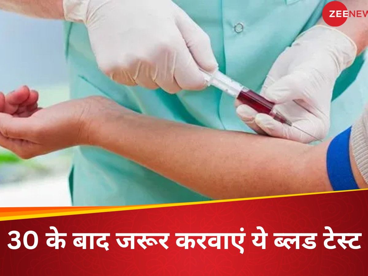 Blood Test: 30 के बाद ये 8 ब्लड टेस्ट जरूरी, आसपास भी नहीं फटकेंगी शरीर को खोखला करने वाली ये बीमारियां