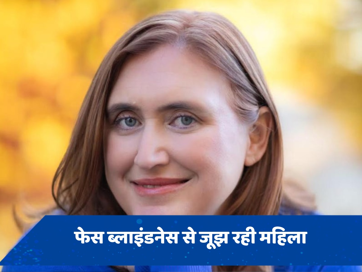 Face Blindness: लोगों से मिलने के बाद तुरंत उनका चेहरा भूल जाती है महिला, अपने पति को भी नहीं पहचानती, जानें वजह