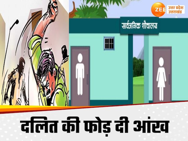 Kushinagar News: सार्वजनिक शौचालय में जाने पर दलित को तालिबानी सजा, फोड़ दी एक आंख 