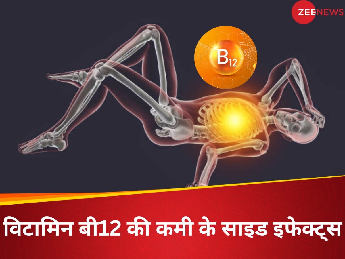 विटामिन बी12 की कमी से मौत हो सकती है? Vitamin B12 Deficiency के लक्षण इग्नोर कर रहे, तो जान लें नुकसान