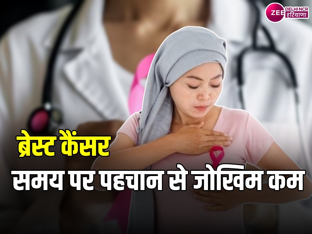 जानलेवा Breast Cancer से कैसे जीती जा सकती है जंग? दिल्ली के एक्सपर्ट ने बताई जरूरी चीज