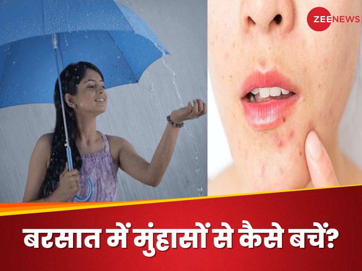 Monsoon Skin Care: बरसात के मौसम में चेहरे की त्वचा को ऐसे रखें हाइड्रेट, वरना आ सकते हैं मुंहासे