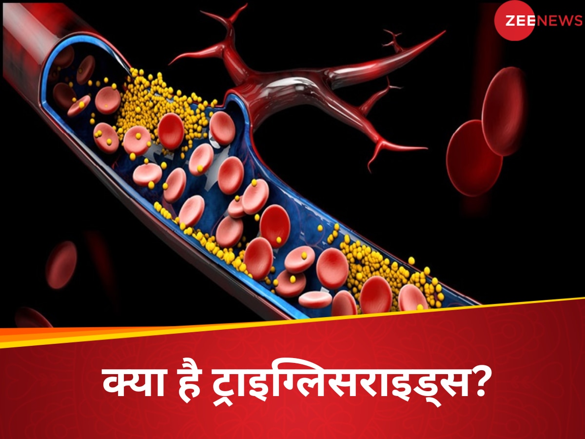 अकेला LDL कोलेस्ट्रॉल ही नहीं, Triglycerides भी करता है दिल को सुन्न, बचने के लिए करें ये उपाय