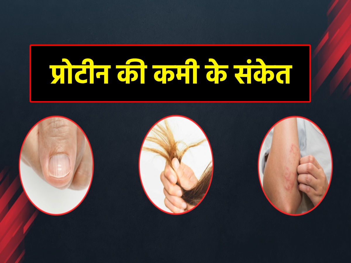 Protein Deficiency: शरीर में 6 बदलाव देते हैं प्रोटीन की कमी के संकेत, तुरंत डाइट में शामिल कर लें ये फूड्स