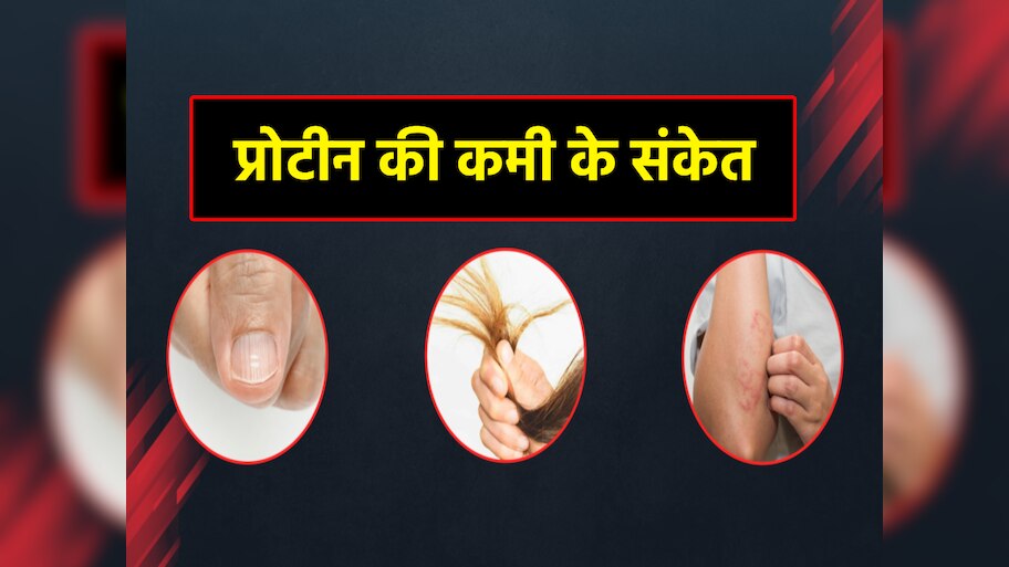 How body give indication of protein deficiency what to eat to overcome ...