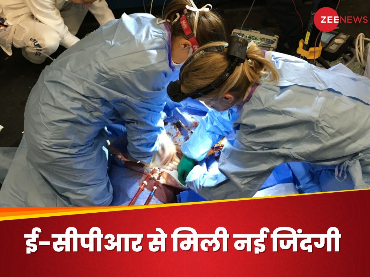 क्या होता है E-CPR?11 साल की बच्ची की बचाई गई जान, हार्ट इंफेक्शन से बिगड़ी थी तबीयत