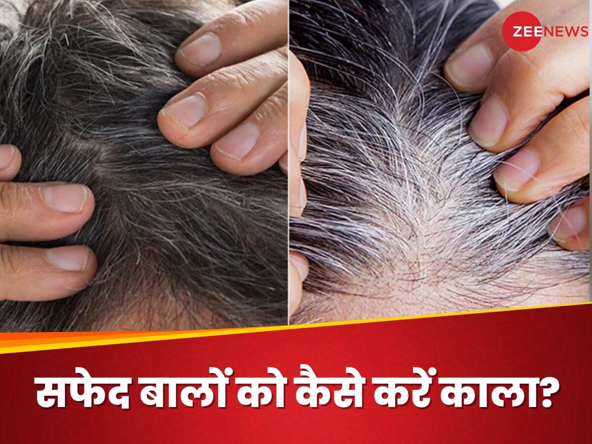 White Hair: सफेद बालों के कारण जवानी में आने लगा बुढ़ापा? इन देसी उपायों के जरिए हेयर होंगे डार्क