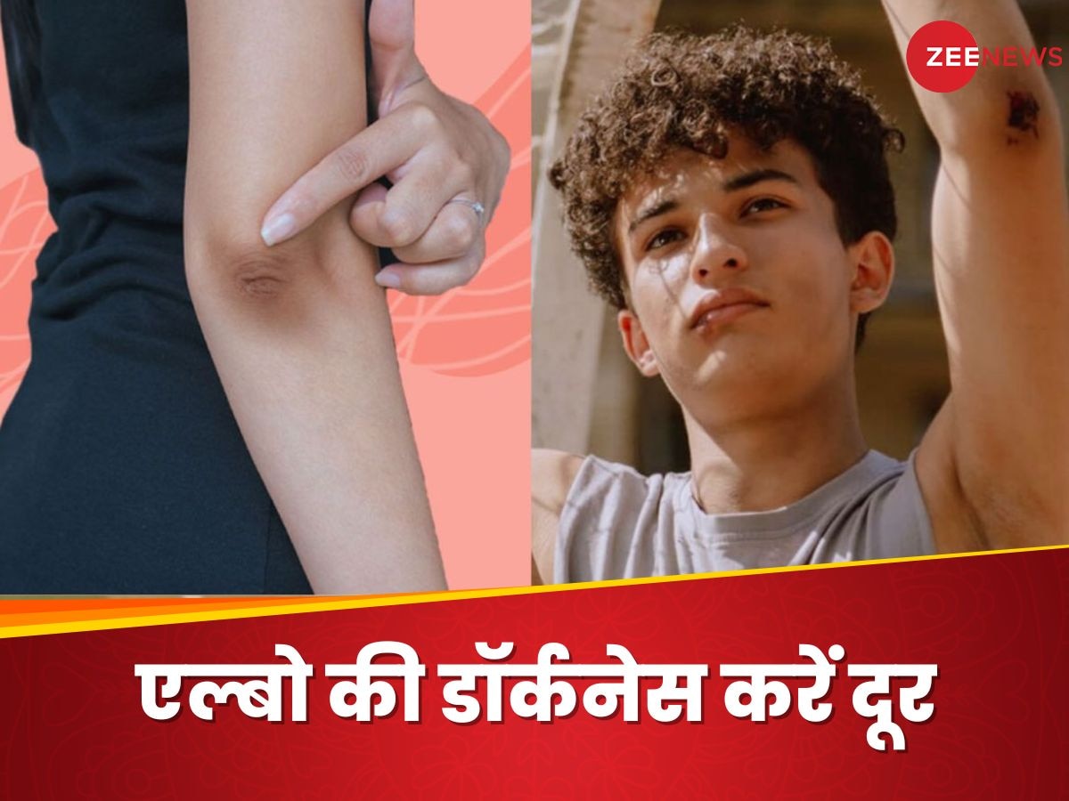 Dark Elbows: कोहनी का कालापन छिपाने के लिए पहनने लगे हैं फुल स्लीव कपड़े? ऐसे दूर होगी डार्कनेस