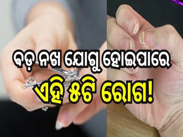 Nail Cutting: ବଡ଼ ନଖ ଯୋଗୁ ହୋଇପାରେ ଏହି ୫ଟି ରୋଗ, ଜାଣନ୍ତୁ କେତେ ଦିନରେ ଥରେ ନଖ କାଟିବା ଜରୁରୀ..