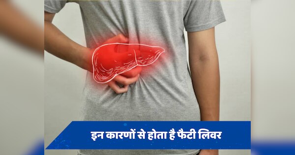 इन गंदी आदतों के कारण लिवर में जमता है फैट, कभी भी बन सकते हैं Fatty Liver का शिकार
